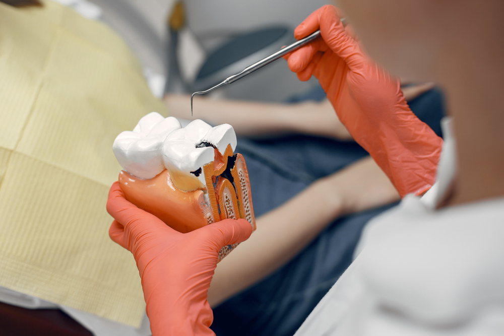 Root Canals in Newark